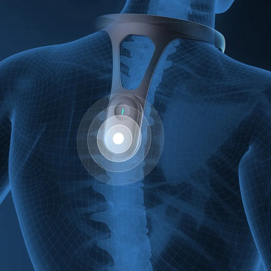Smart Posture Corrector with Vibration Alert